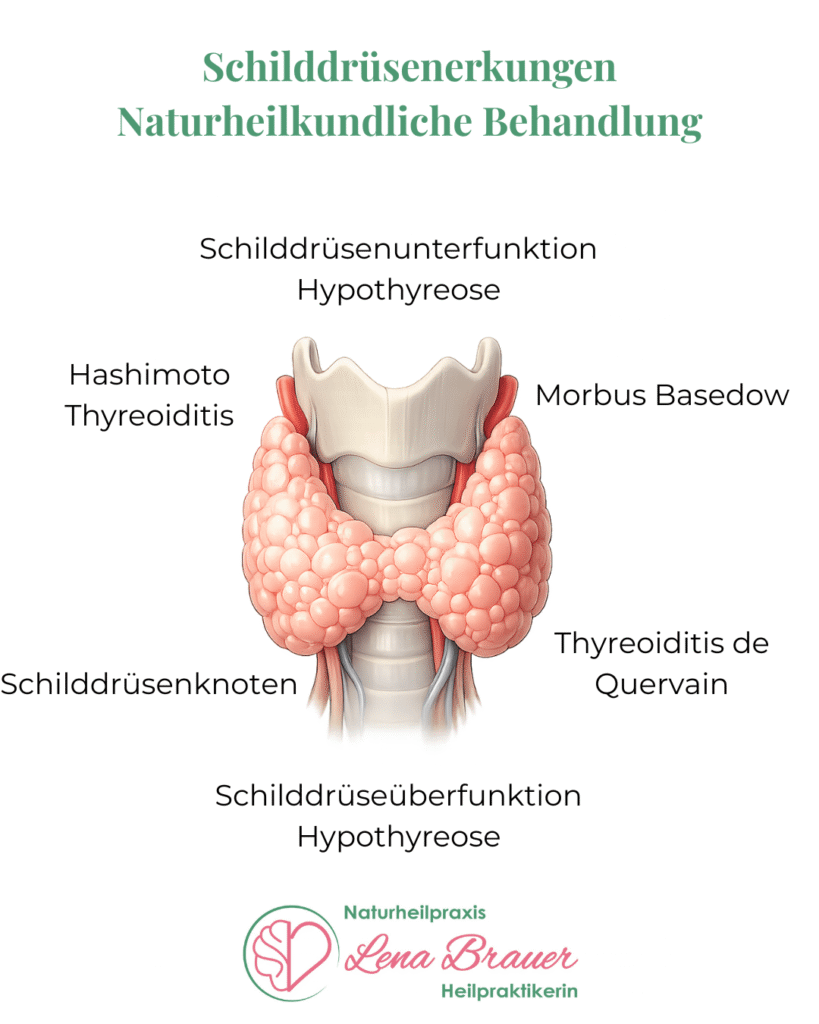 Bild Schilddrüsenerkrankungen Naturheilkunde
