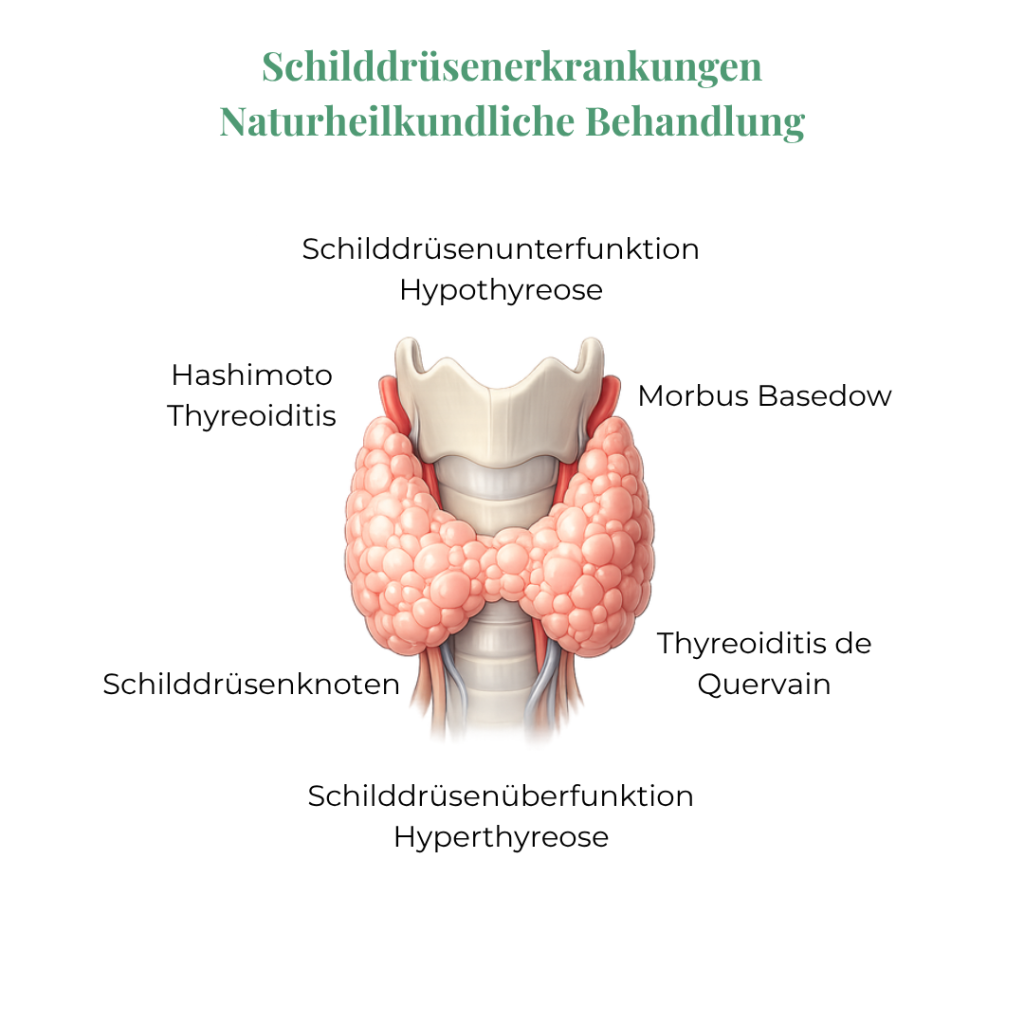 Schilddrüsenerkrankungen naturheilkundlich behandeln